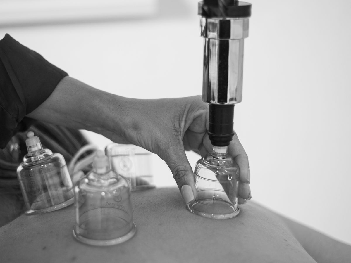 Hijama pour les douleurs dorsales